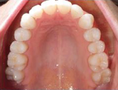 Virtual Consultation - Family Orthodontics