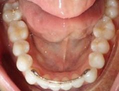 Virtual Consultation - Family Orthodontics