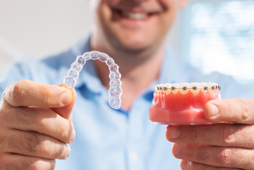 Brace Options - different types of braces that you can choose from