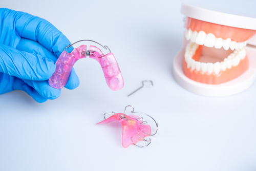 orthodonic appliances - Family Orthodontics