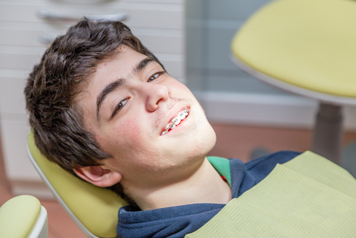 Oral Hygiene with Braces - Getting oral support at Family Ortho