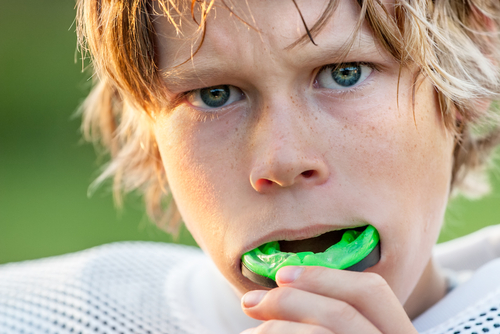 Sports Mouth Guards - to help protect your teeth