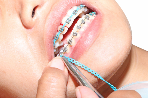 emergency orthodontic care - for your minor dental emergencies at Family Orthodontics