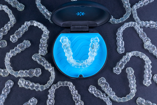 Invisalign Timetable - How long will you have to wear your Invisalign and beyond that