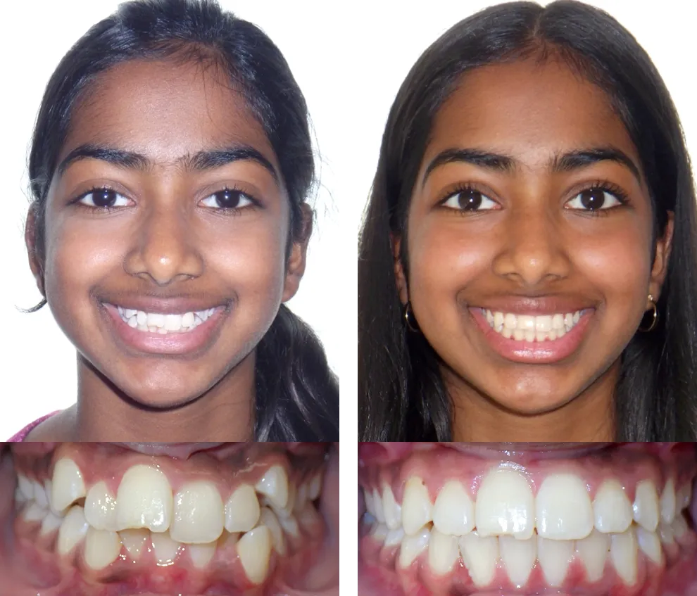 Thanvisha G